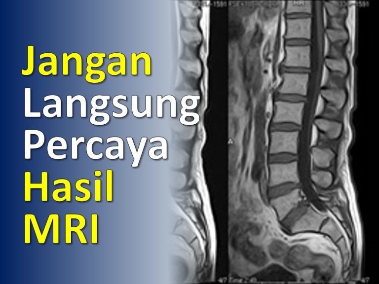 Tidak Semua yang Tampak pada MRI Pasti Penyebab Sakit Punggung Anda Tidak Semua yang Tampak pada MRI Pasti Penyebab Sakit Punggung Anda