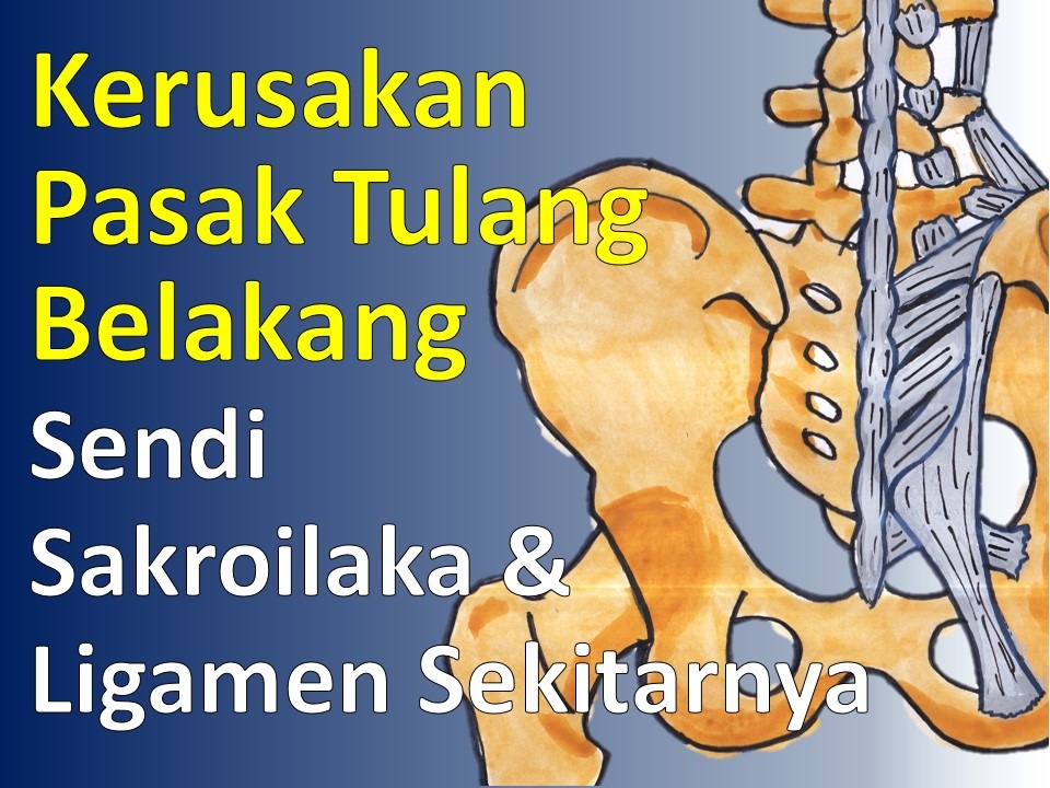 Sakit Punggung karena Kerusakan Pasak Tulang Belakang Sakit Punggung karena Kerusakan Pasak Tulang Belakang