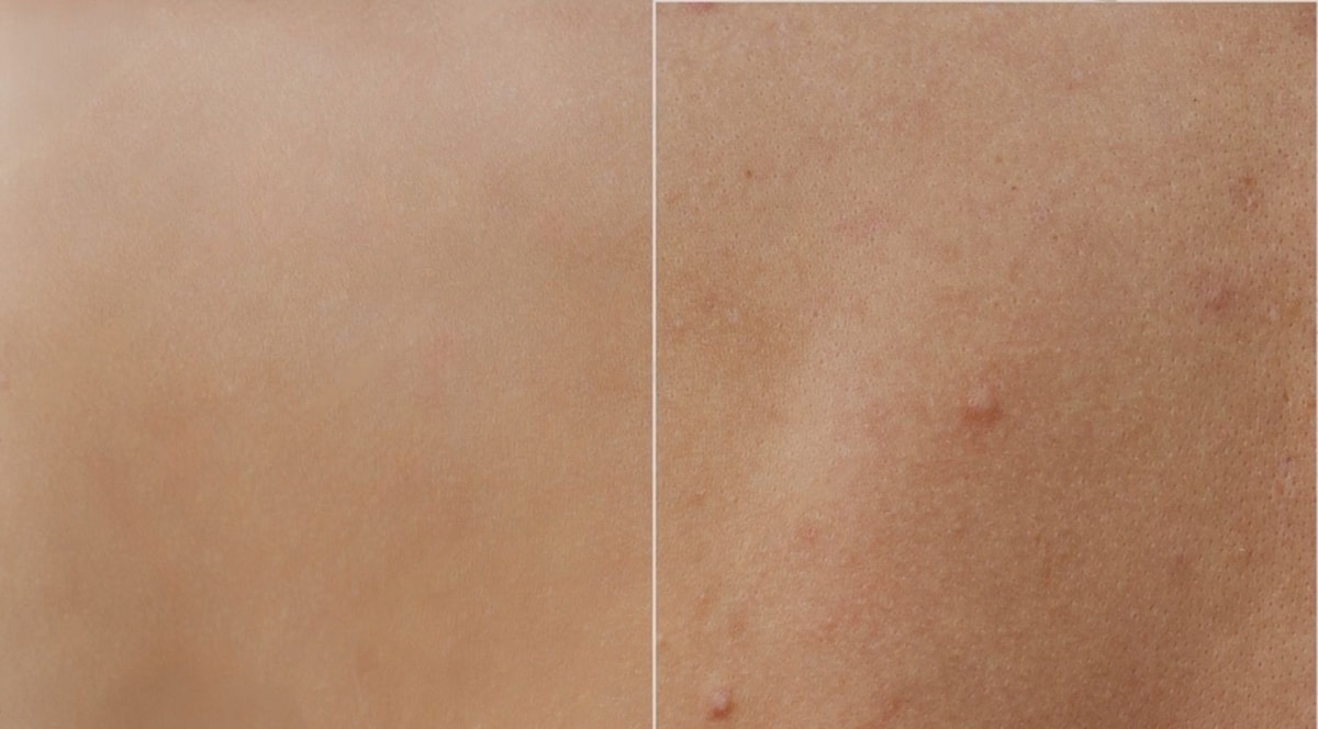 Kulit Perih, Merah, dan Kering? Kenali Penyebabnya, Pilih Skincare yang Cocok Kulit Perih, Merah, dan Kering? Kenali Penyebabnya, Pilih Skincare yang Cocok