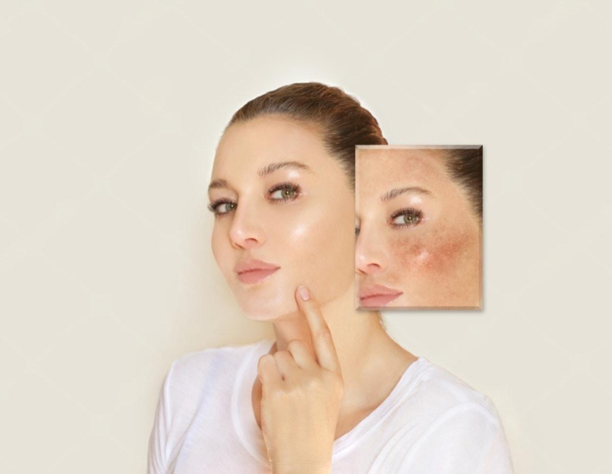 Bintik Hitam Muncul di Pipi? Bukan Cuma Faktor Usia, Lho! Bintik Hitam Muncul di Pipi? Bukan Cuma Faktor Usia, Lho!