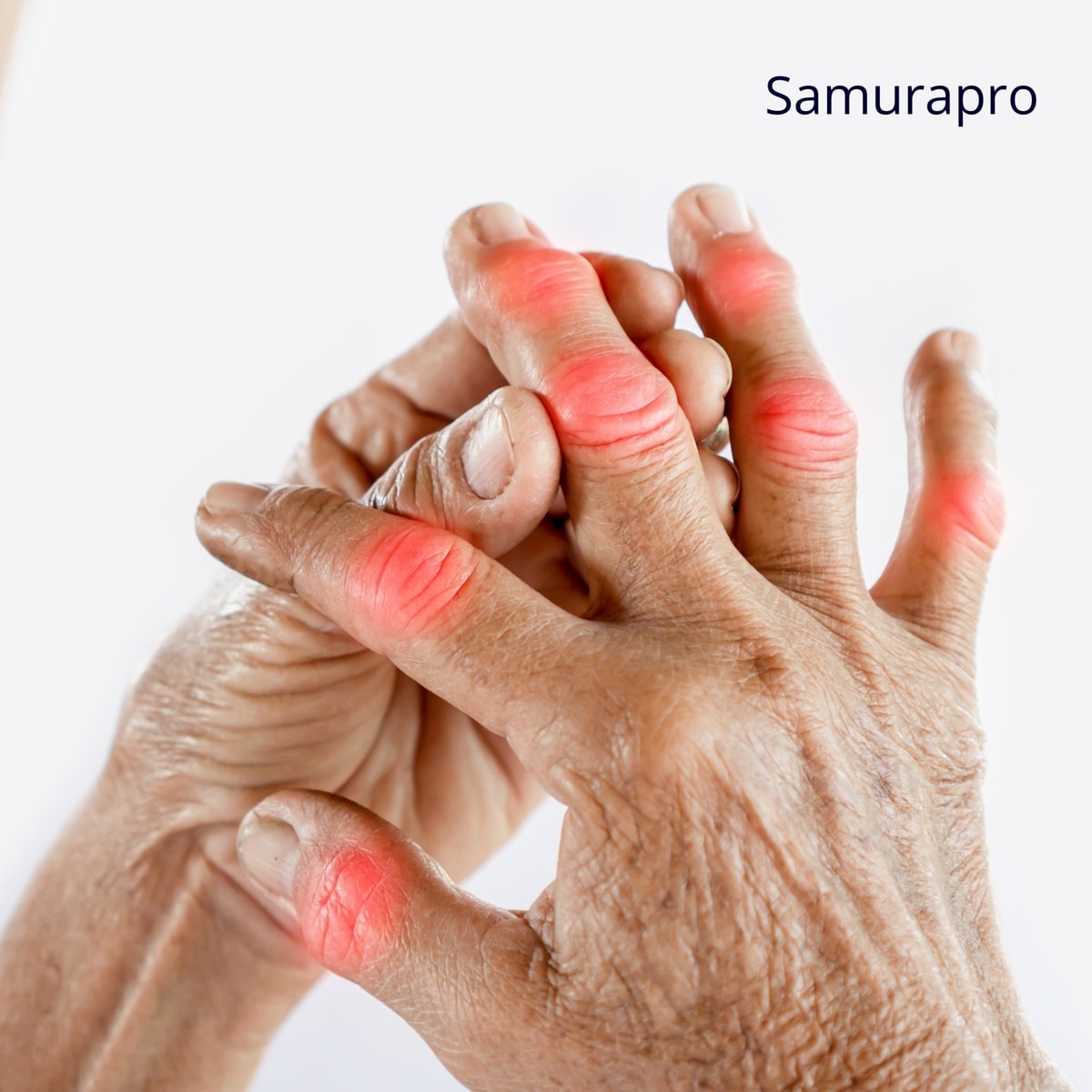 Asam Urat dan Rematik, Apa Bedanya? Asam Urat dan Rematik, Apa Bedanya?