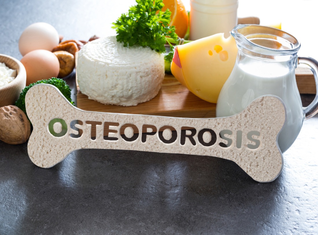 Panduan Nutrisi untuk Memperkuat Tulang dan Mencegah Osteoporosis
