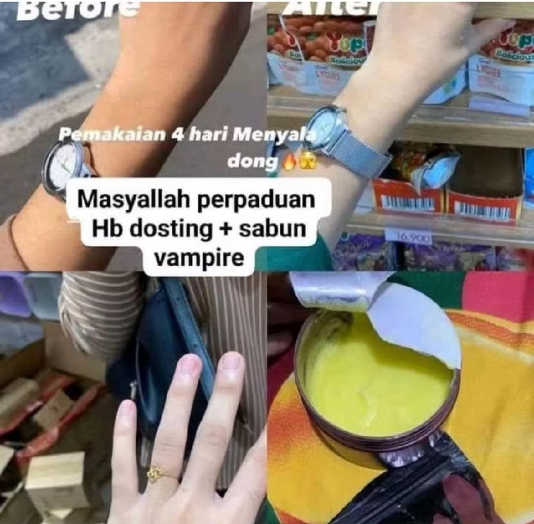 -