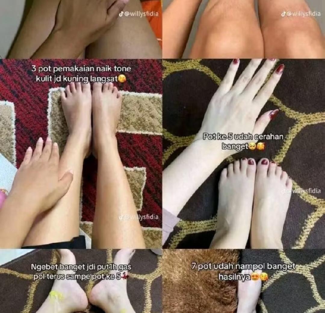 -