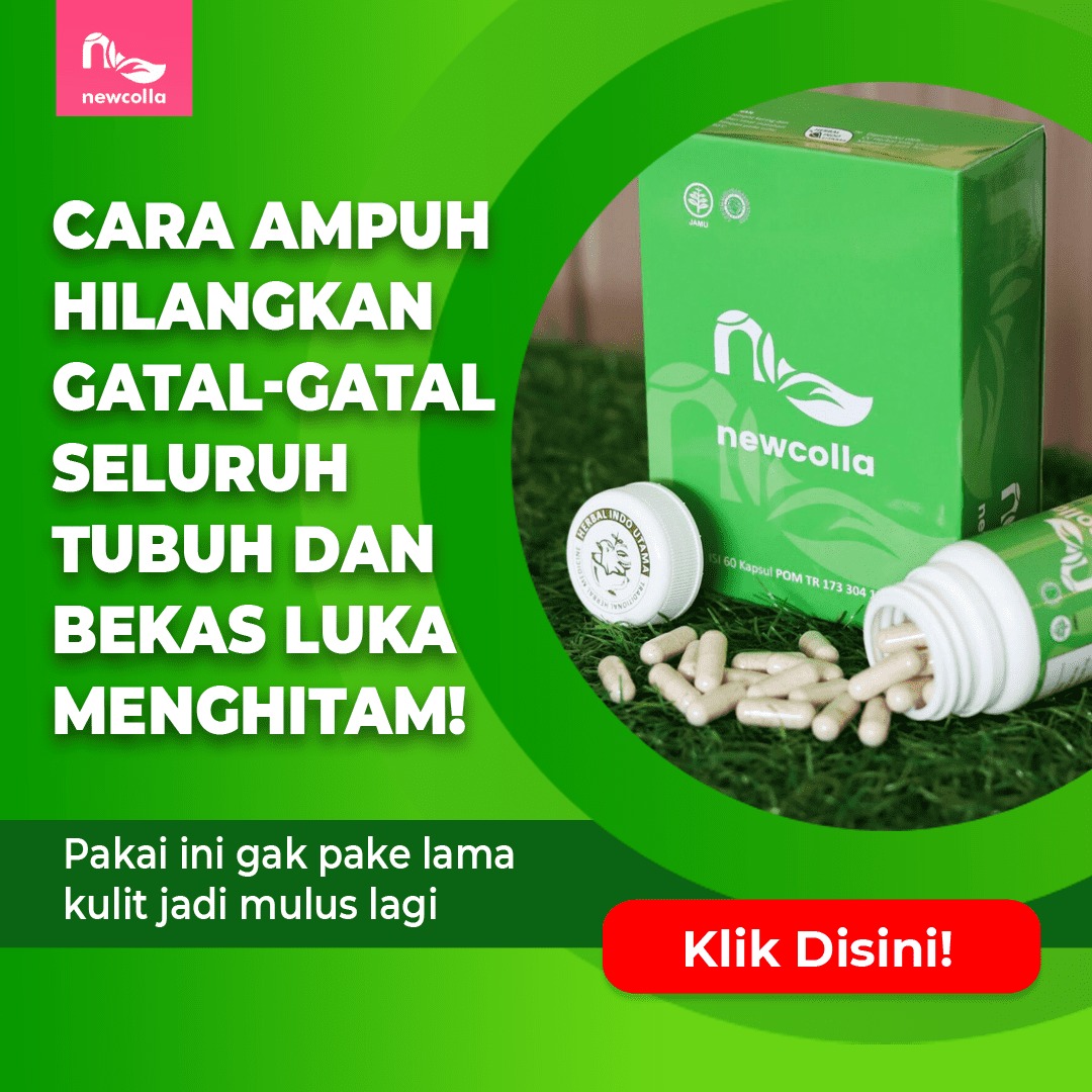 Daripada digaruk, lebih baik cegah gatal dengan bahan alami ini!