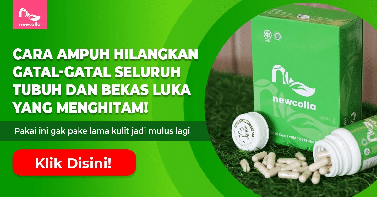 Cegah gatal-gatal hingga hilangkan bekas cuma pakai bahan alami yang sudah terbukti aman, ber-BPOM dan halal ini.