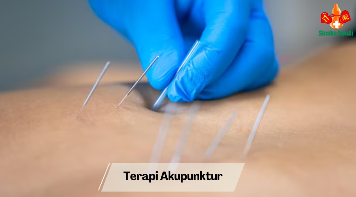 Terapi Akupunktur