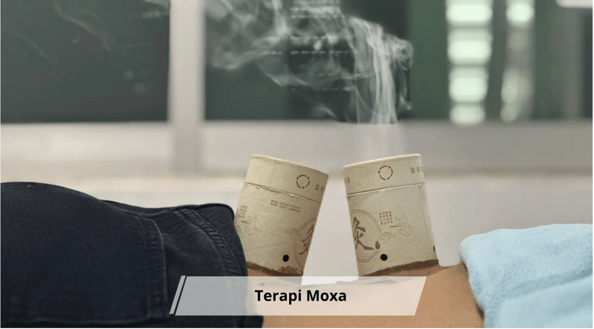 Terapi Moxa (Moksibusi) dalam TCM: Manfaat, Cara Kerja, dan Khasiatnya bagi Kesehatan