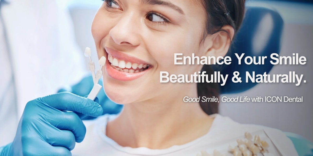 Perawatan Veneer di Jakarta dengan ICON Dental