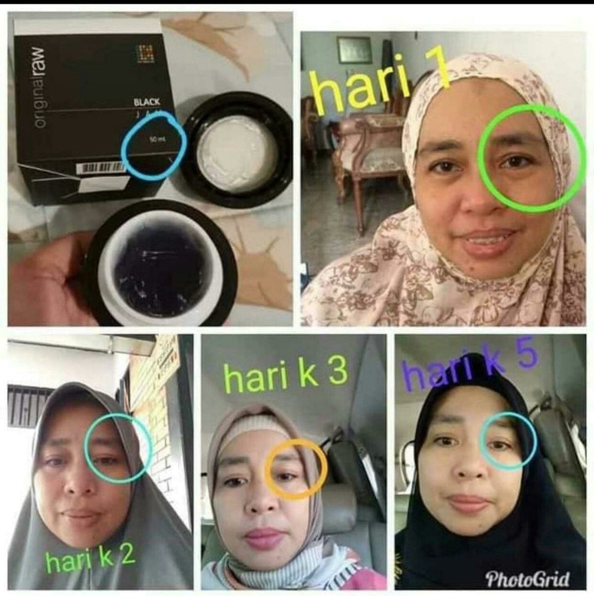 -