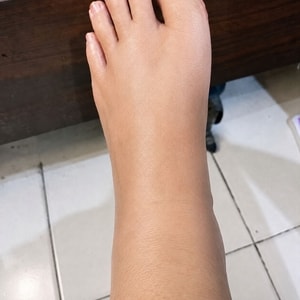 -