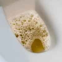 Kencing Berlebih & Berbusa