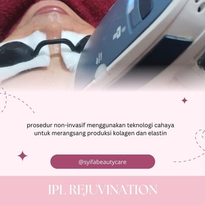 IPL Rejuvination