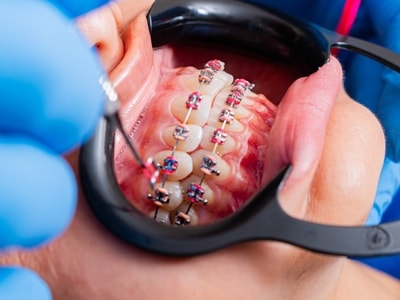 orthodontic