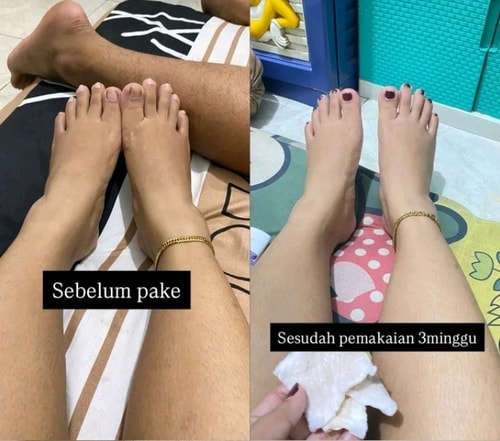 -