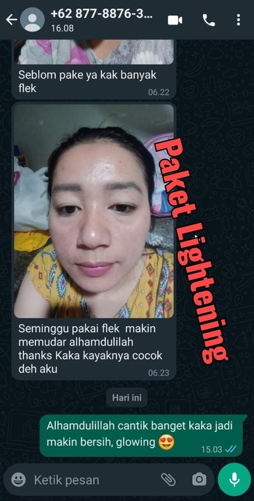 -