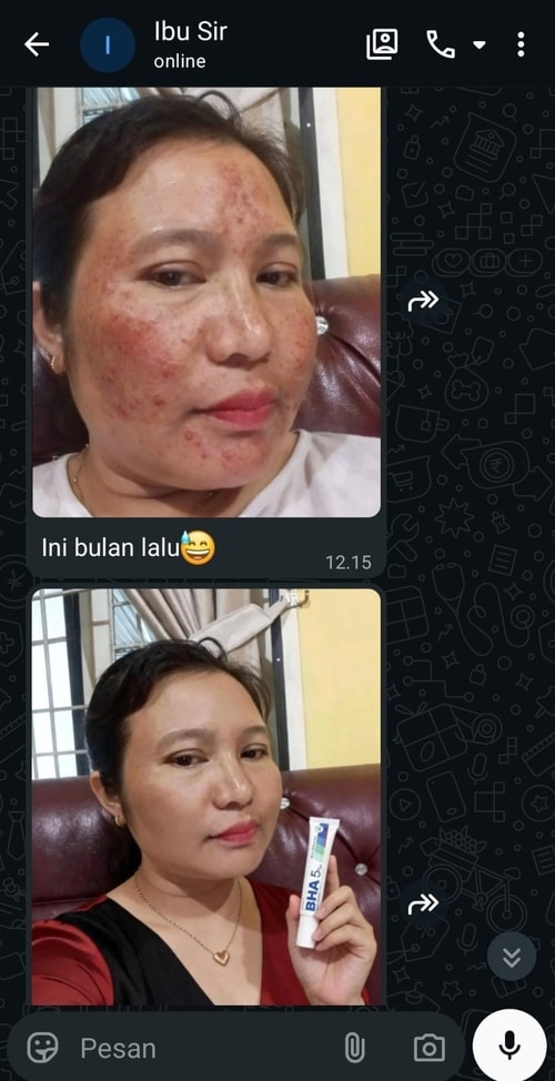 -