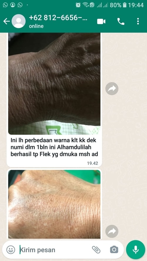 testimoni dvn collagen