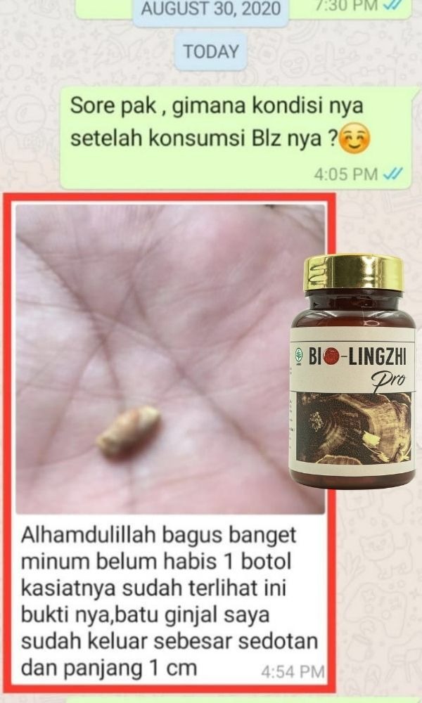 Testimoni Bio Lingzhi Pro
