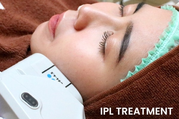 IPL Laser Alamin Skincare: Solusi Lengkap untuk Kulit Cerah, Bebas Flek & Jerawat!