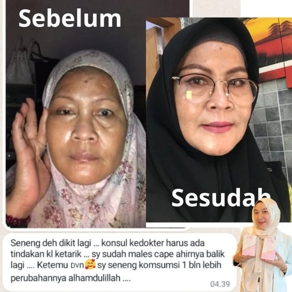 -