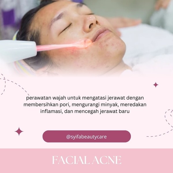 Facial Acne