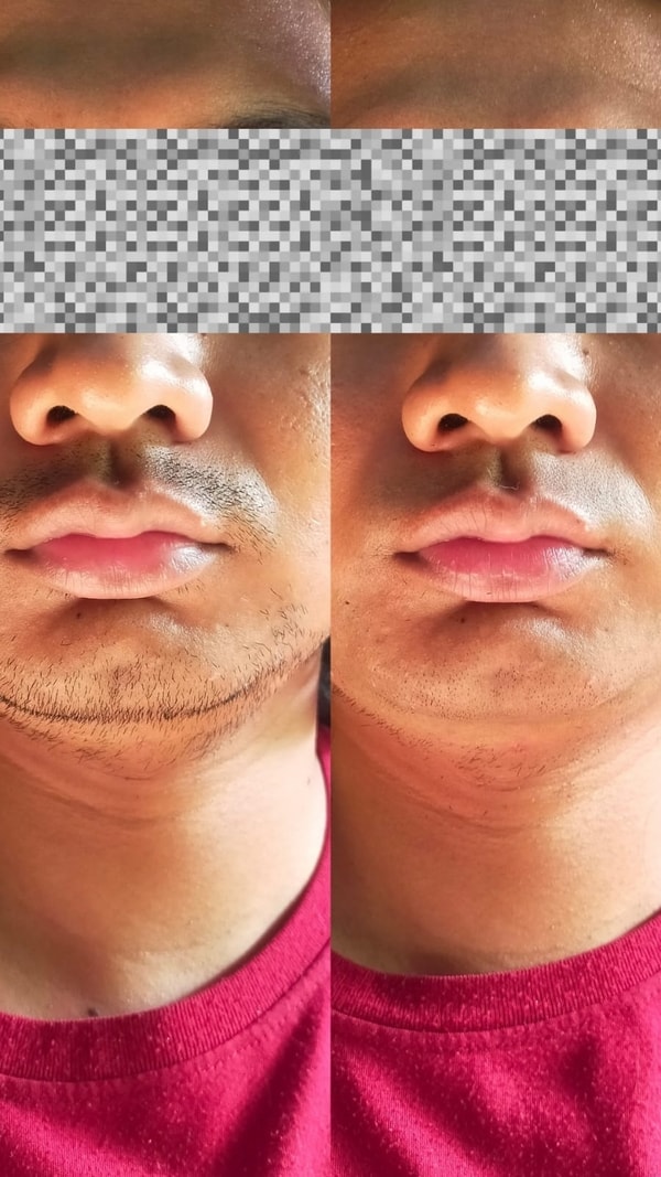 -