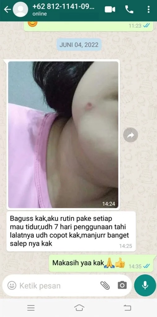 -