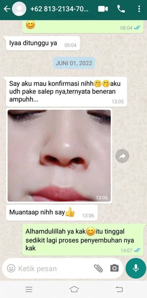 -