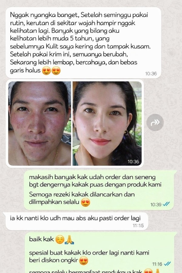-
