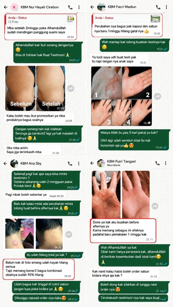 -