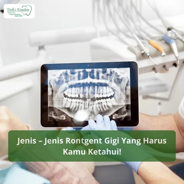 Jenis-jenis rontgen gigi