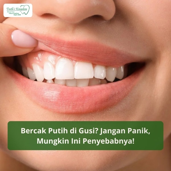 Bercak Putih di Gusi? Jangan Panik, Mungkin Ini Penyebabnya!