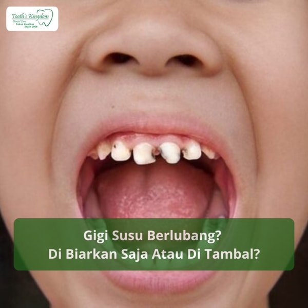GIGI SUSU BERLUBANG
