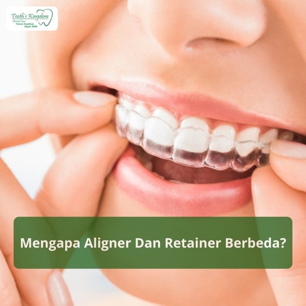 Mengapa Aligner Dan Retainer Berbeda?