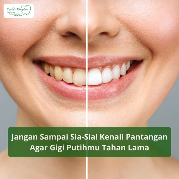 Jangan Sampai Sia-Sia! Kenali Pantangan Agar Gigi Putihmu Tahan Lama