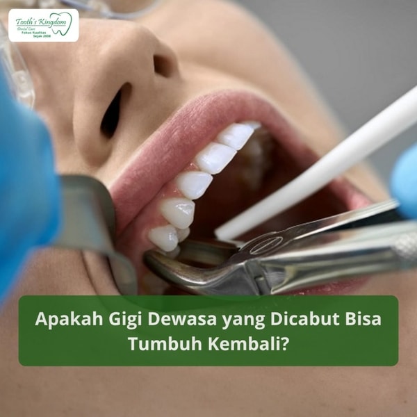 Apakah Gigi Dewasa yang Dicabut Bisa Tumbuh Kembali?