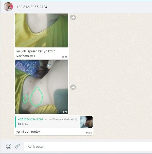 -