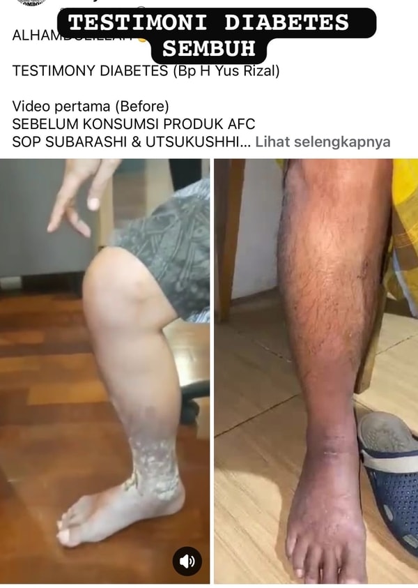 -