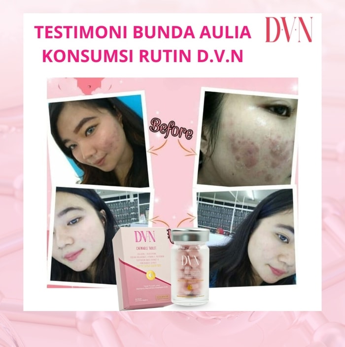 dvn dvn original dvn asli  dvn collagen dvn colagen dvn collagen asli dvn collagen original  dvn kolagen wellous dvn dvn collagen official store