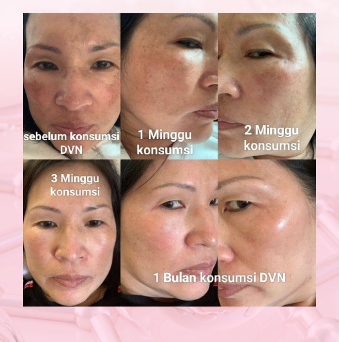 dvn dvn original dvn asli  dvn collagen dvn colagen dvn collagen asli dvn collagen original  dvn kolagen wellous dvn dvn collagen official store