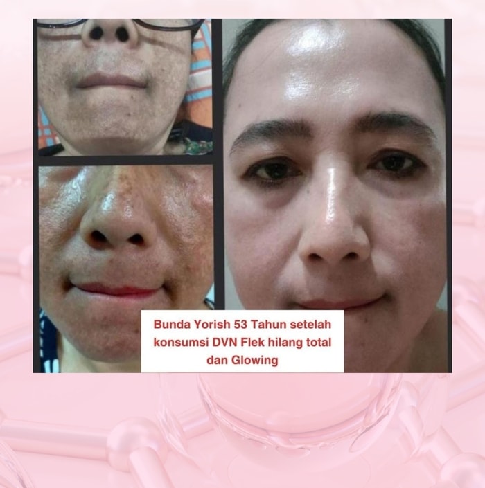 dvn dvn original dvn asli  dvn collagen dvn colagen dvn collagen asli dvn collagen original  dvn kolagen wellous dvn dvn collagen official store