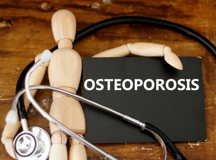 Cara Efektif Menurunkan Risiko Osteoporosis Sejak Usia Muda