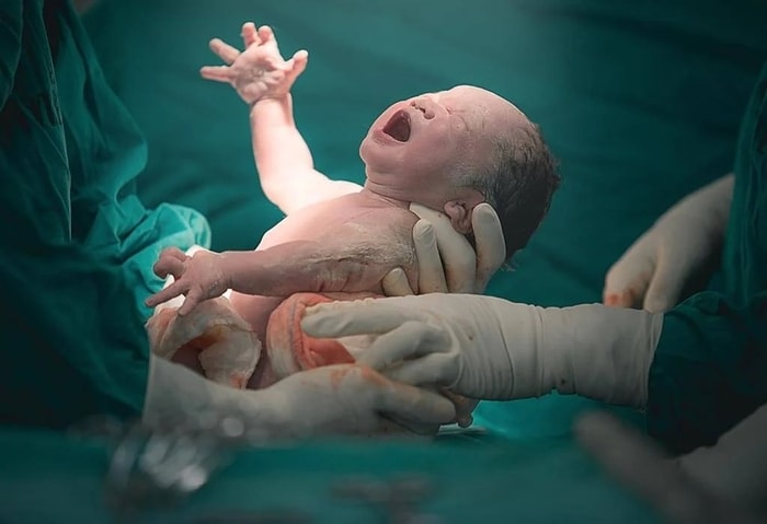 Cara Kita Dilahirkan Menentukan Microbiome Kita