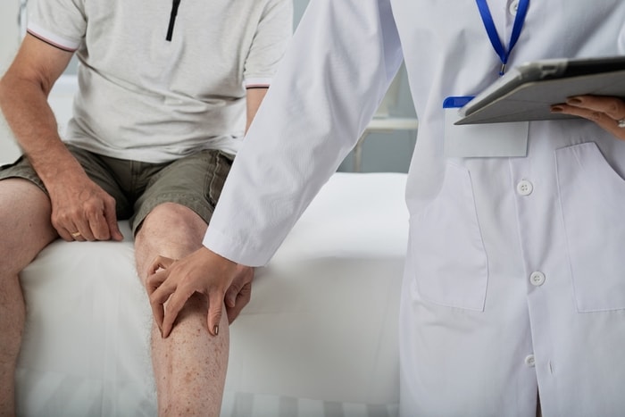 Robekan Ligamen Lutut: Bukan Hanya Cedera Atlet, Siapa Saja Bisa Mengalaminya!