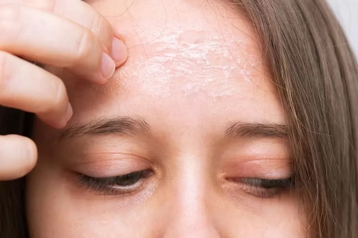 5 Kebiasaan Sehari-hari yang Bisa Merusak Skin Barrier