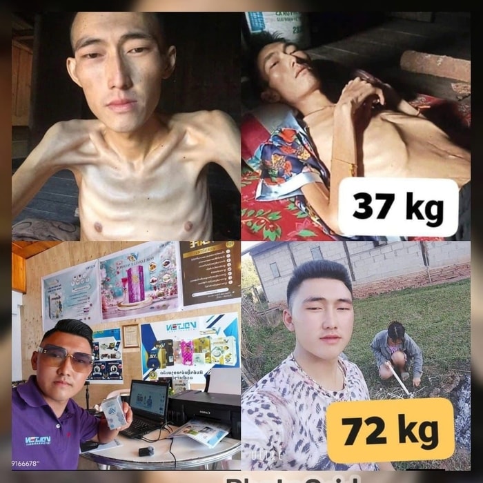 Testimoni sehat dari tuberkolosis dan gangguan lambung