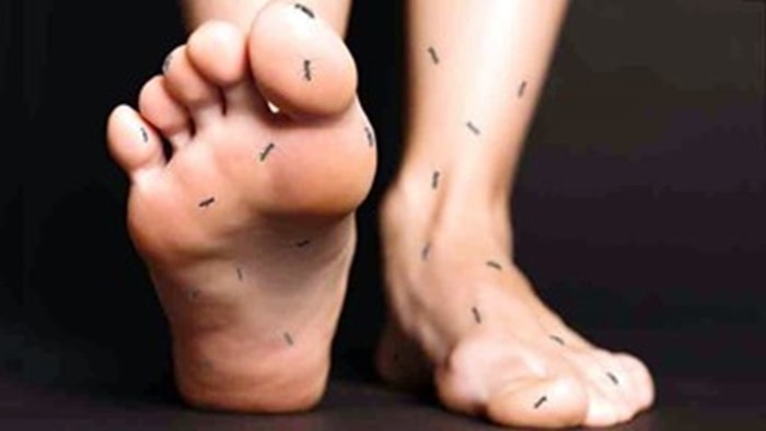 -