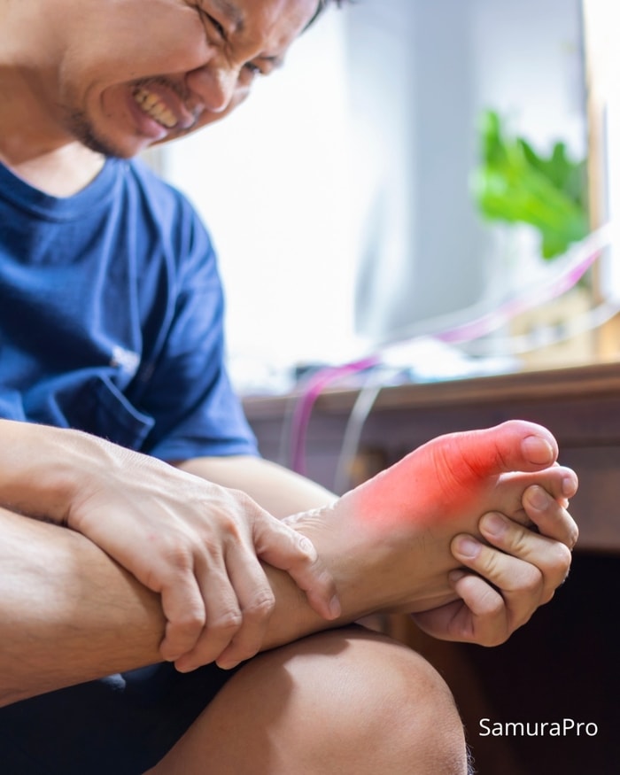 Asam Urat di Usia Muda, Kenapa Sekarang Makin Banyak Terjadi?