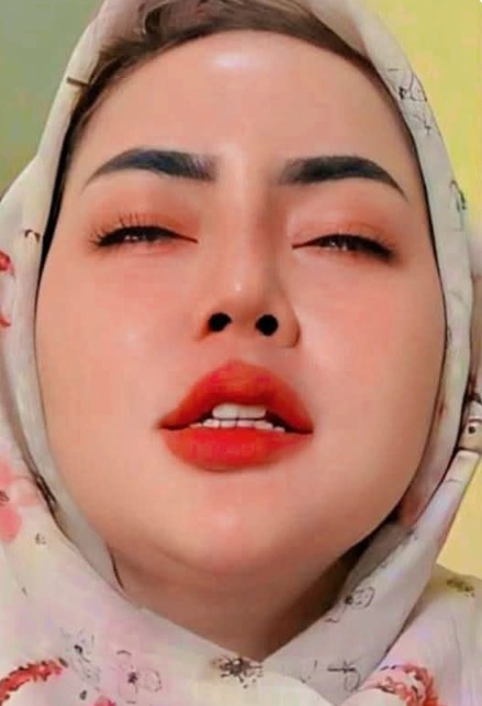 -